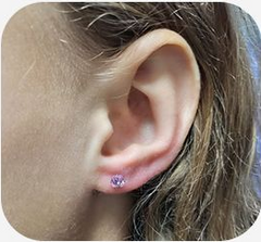 Pierced ear